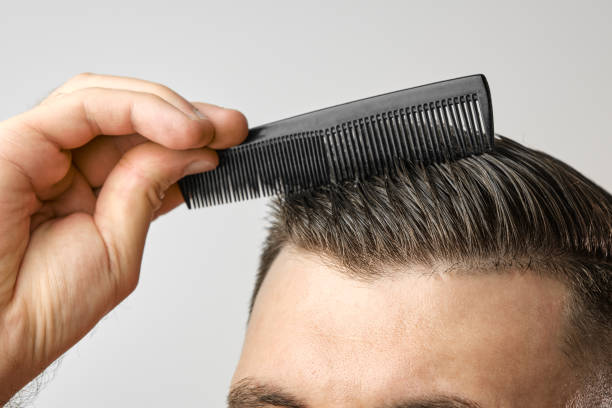 How Much Does Hair Transplant Cost with DHI Method?
