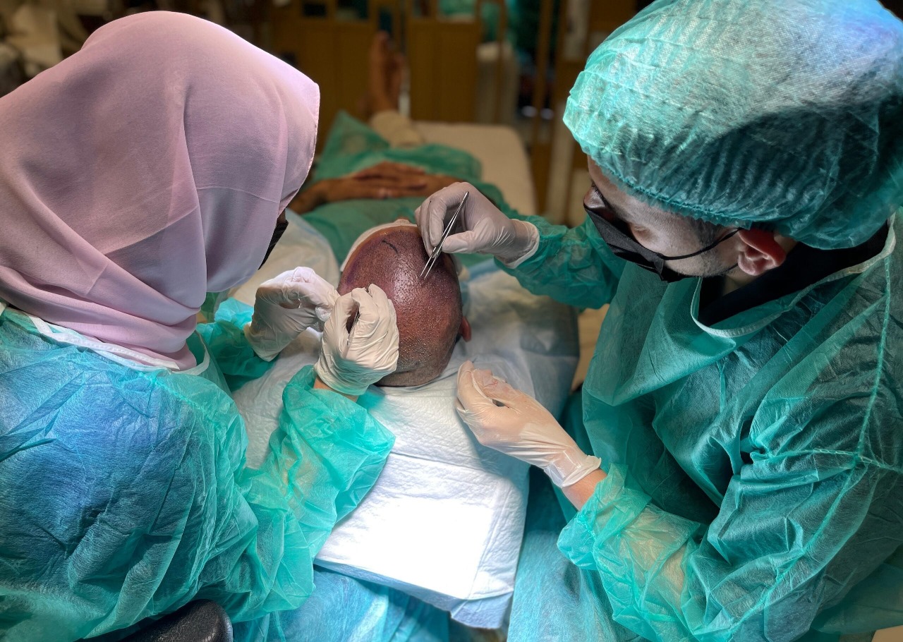 Hair Transplant London – Before and After Results That Inspire